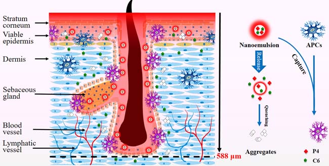 Schematic presentation of penetration of nanoemulsions into the viable epidermis and accumulation in the peri-follicular sites, implying capturing by APCs as well as potential application in TCI.