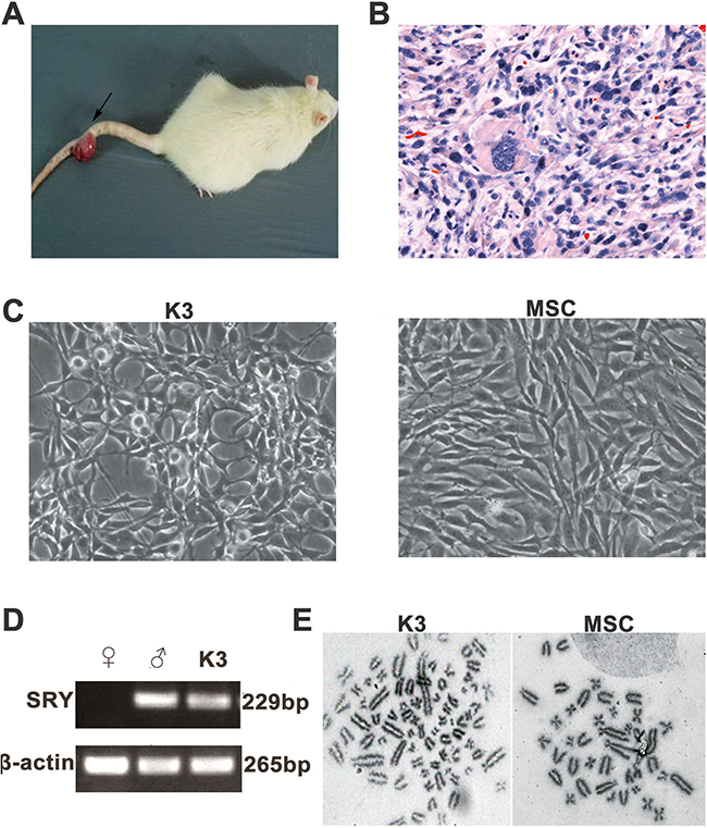 Isolation and identification of the rBM-MSC-transformed tumor cell line K3.
