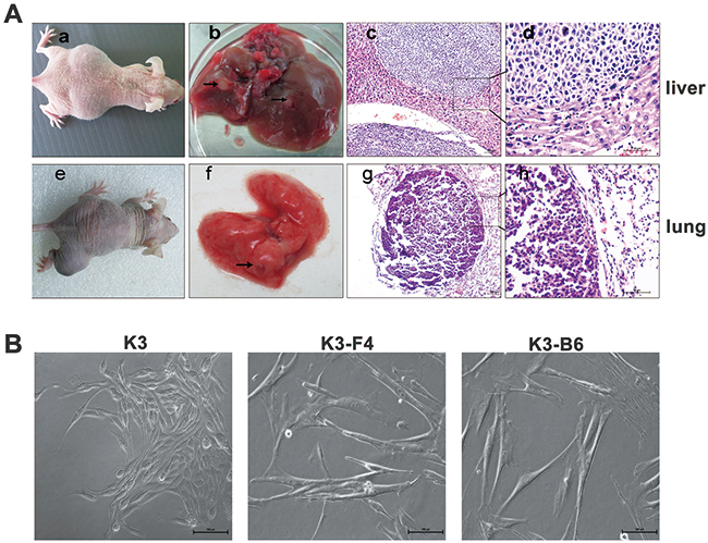 K3 metastatic cell lines possessed higher metastatic and invasive potential.