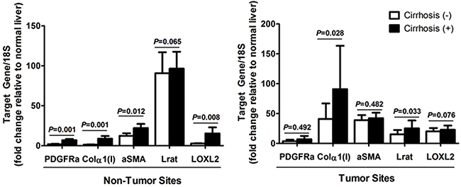 Expression of PDGFR&#x03B1; and other fibrosis related genes in (A) non-tumor sites, and (B) tumor sites according to the existence of liver cirrhosis.