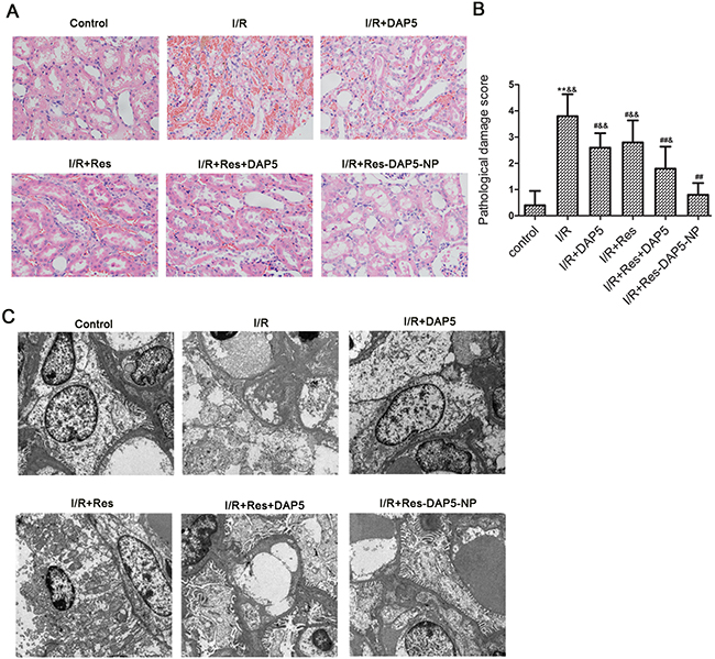 Histopathologic evaluation of kidney I/R injury.