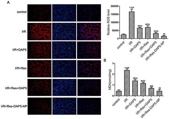 Effects of Res-DAP5-NP on oxidative stress in rats induced by renal I/R injury.