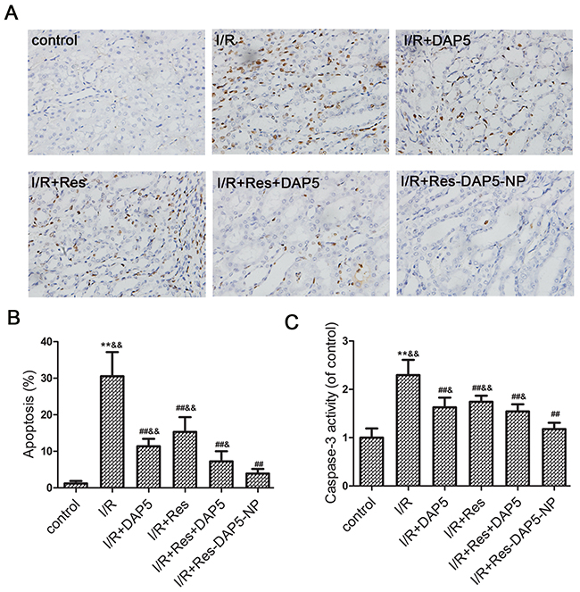 Effects of Res-DAP5-NP on cell apoptosis induced by renal I/R injury.