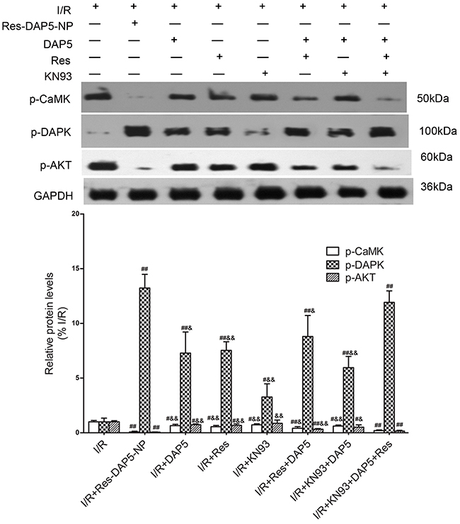 Effects of Res-DAP5-NP on expression of p-CaMK, p-DAPK, and p-AKT in rats induced by renal I/R injury.