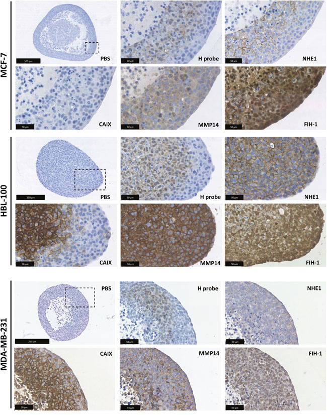 3D target protein expression in multicellular tumor spheroids.