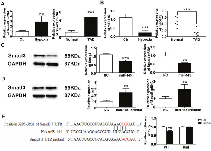 miR-145/Smad3 signal pathway promotes aortic remodeling.