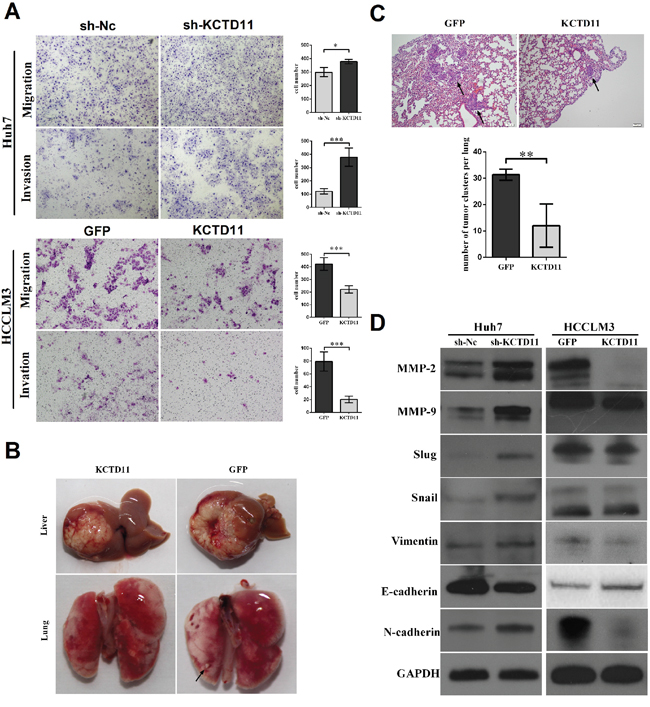 KCTD11 inhibits cell migration and invasion in HCC in vitro and inhibits tumor metastasis in vivo, by repressing MMPs and EMT.