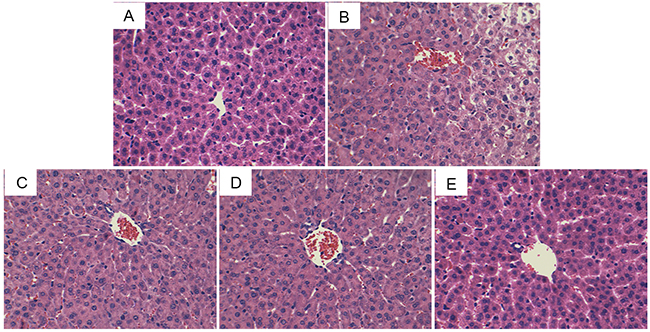 Effects of ADH on histopathological changes in liver tissues.
