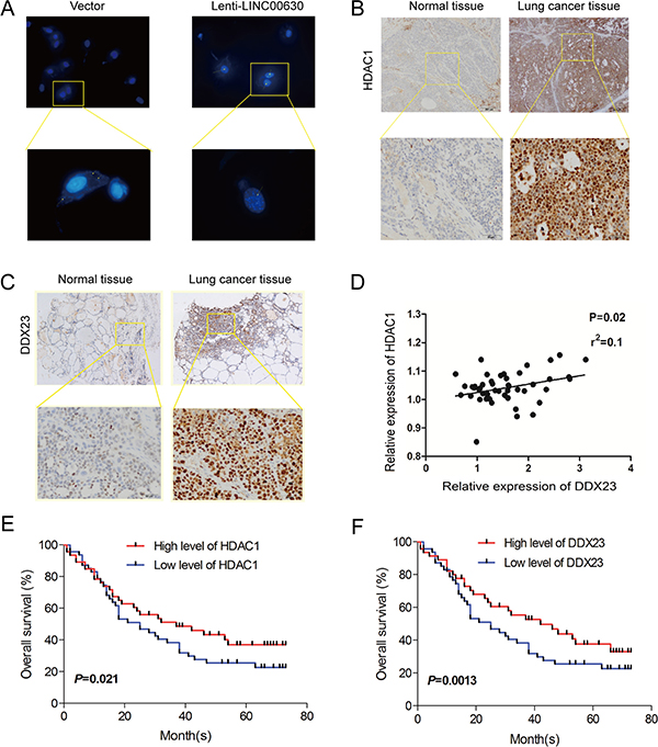 A positive correlation between HDAC1/ DDX23/ linc00630 in NSCLC tissues.