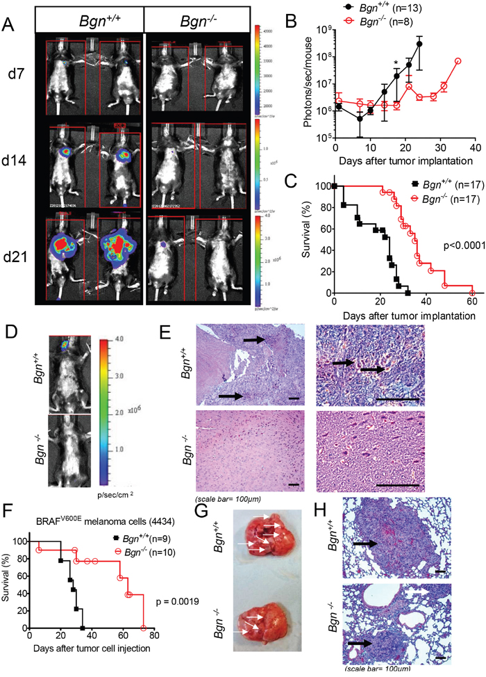 Bgn deficiency of tumor stroma inhibits metastasis formation in vivo.