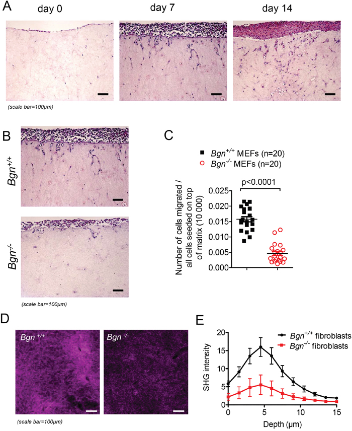 Invasion of melanoma cells is reduced in the absence of Bgn in fibroblasts.