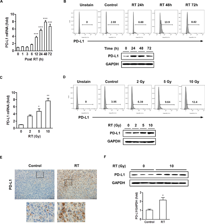 Radiation increased the expression of PD-L1 in vitro and in vivo.