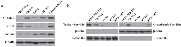 LAPTM4B, VEGF, nuclear and cytoplasmic survivin protein expression in breast cell lines by Western blot analysis.