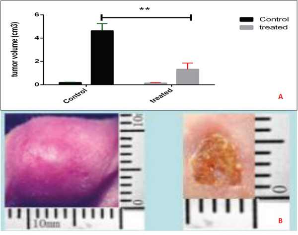 Tumor volume in murine transplanted hepatocellular carcinoma with high metastatic potential.