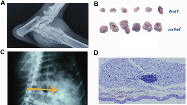 The radiology and pathology of the primary tumor and lung metastasis.