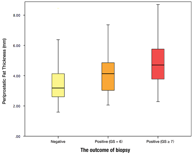 Periprostatic fat thickness (PPFT) distribution by the outcome of biopsy.