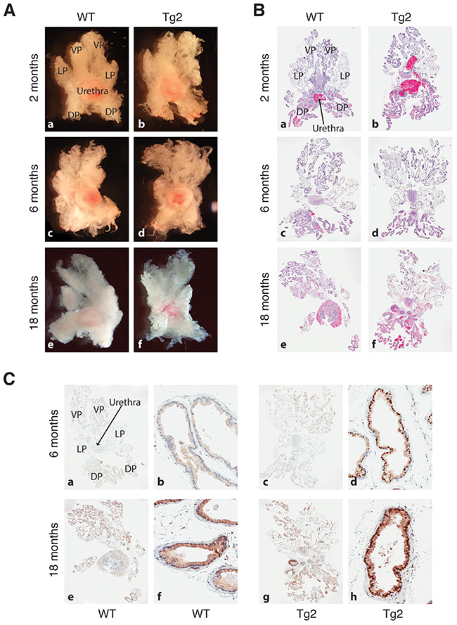 Prostate morphologies in WT and Tg2 mice at different ages.