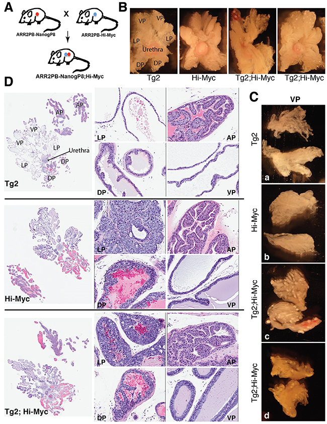 Gross morphological and histological changes in Tg2; Hi-Myc double transgenic prostates.