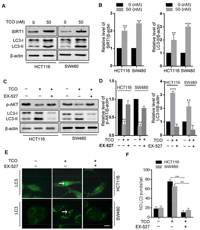 Toxicarioside O induces autophagy through up-regulation of SIRT1 in colorectal cancer cells.