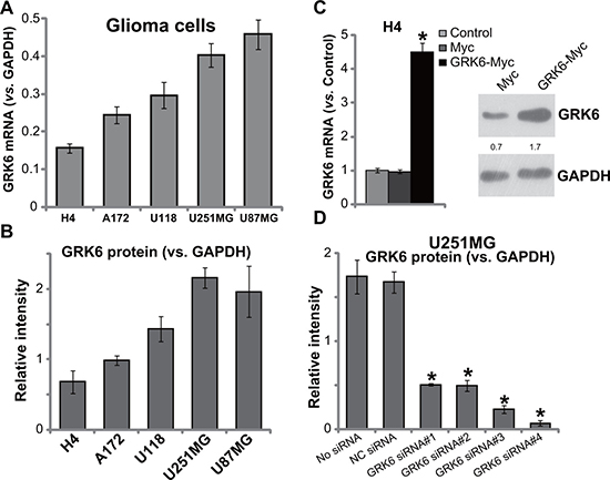 GRK6 expression in human glioma cell lines.