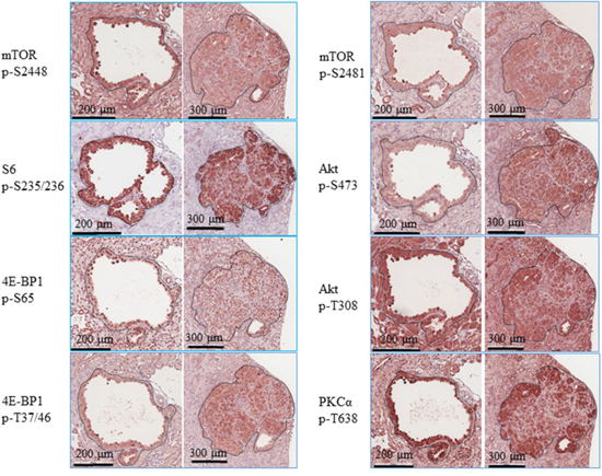 PI3K/Akt/mTOR signalling in renal tumours of Tsc2+/- mice.