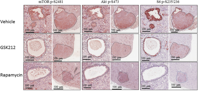 Effect of GSK2126458 and rapamycin on mTOR signalling of renal tumours in Tsc2+/- mice.