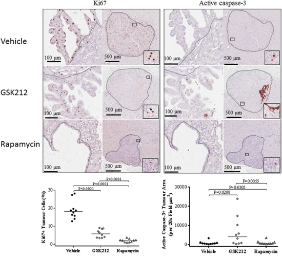 Effect of GSK2126458 and rapamycin on proliferation and apoptosis of renal tumour cells in Tsc2+/- mice.