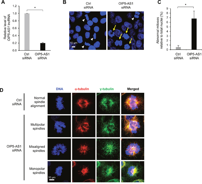 Silencing OIP5-AS1 induces abnormal mitotic cell division.