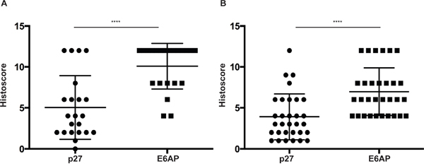 Expression levels of E6AP and p27 inversely correlate in PC.