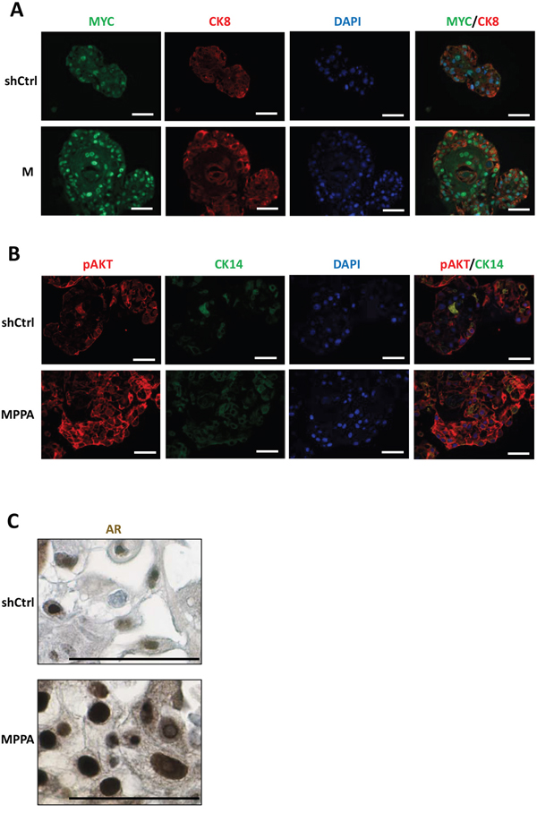 Assessment of MYC, p-AKT, and AR expressions in organoids.