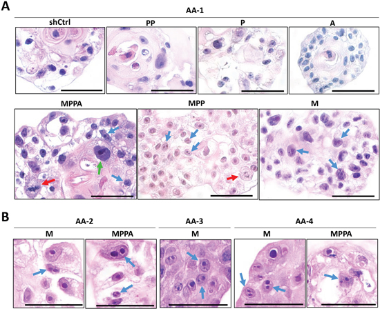 Assessment of malignant transformation of organoids in vitro.