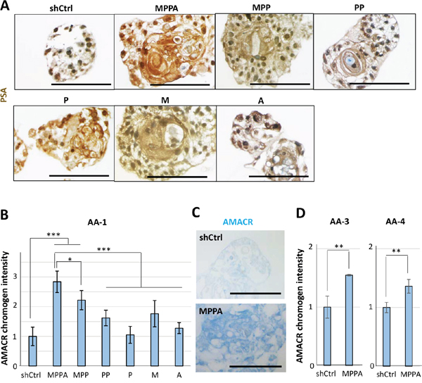 Immunohistochemical staining for prostate-specific antigen (PSA) and &#x03B1;-methylacyl-CoA racemase (AMACR) in organoids.