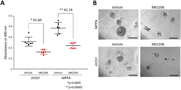 Drug treatment response in organoids.