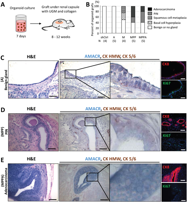 In vivo tumorigenicity of transformed organoids.