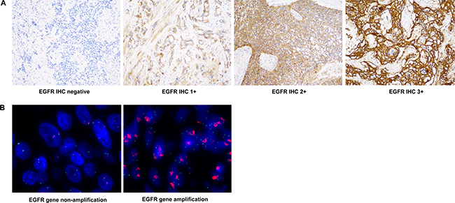 Representative images of EGFR IHC and FISH.