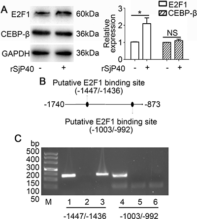 Transcription factor E2F1 binds to the -1740/-873 activity region of the p27 promoter.