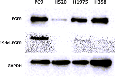 Western blot of EGFR and 19del-EGFR expression level in 4 NSCLC tumors.