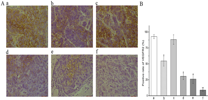 Expression of VEGFR-2 in CNE-2 NPC tumor tissue.