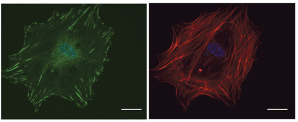 Microscopic visualization of FAs.