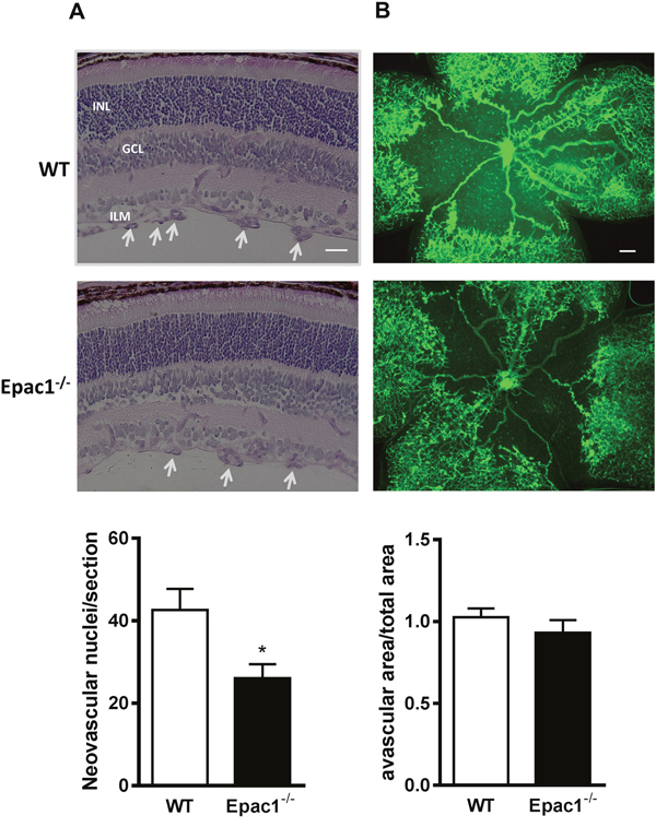 Retinae of Epac1-/- mice are protected from oxygen-induced vascular damage.