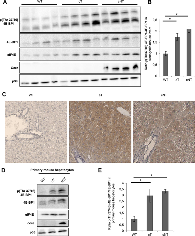HCV core variants mediate 4E-BP1 phosphorylation in transgenic mouse livers.