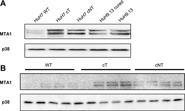 HCV core induces the expression of MTA1, a 4E-BP1 downstream target.