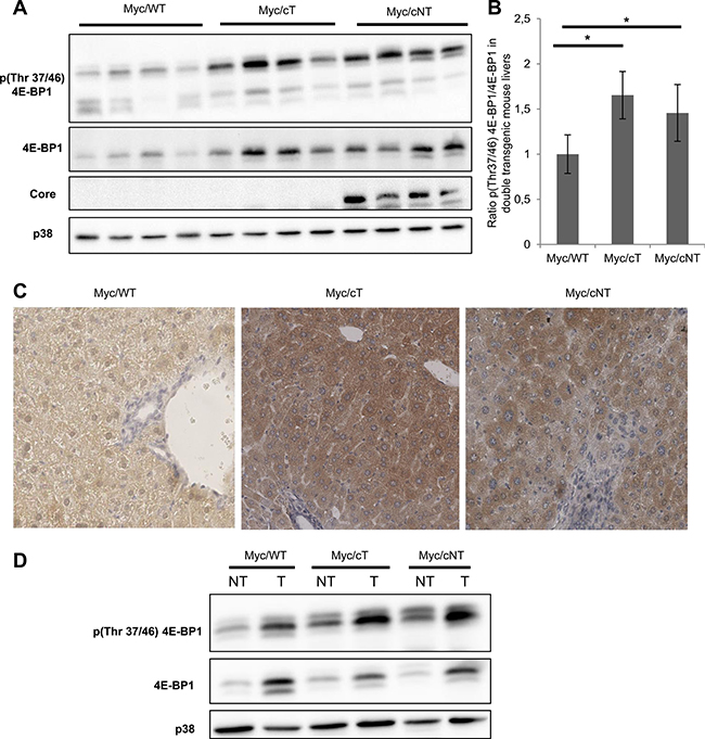 HCV core increases 4E-BP1 phosphorylation level in Myc/cT and Myc/cNT mouse livers.