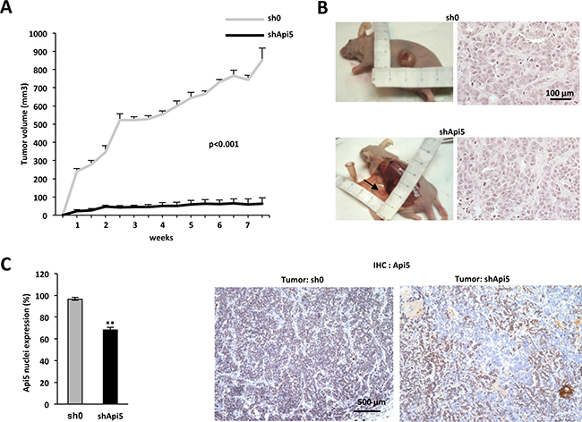 Api5 favors tumorigenicity in vivo.