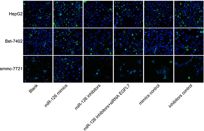 Comparisons of cell apoptosis among the blank, miR-126 mimics, miR-126 inhibitors, miR-126 inhibitors + siRNA EGFL7, mimics control and inhibitors control groups in smmc-7721, Bet-7402, and HepG2 cell lines after transfection ( &#x00D7; 400).