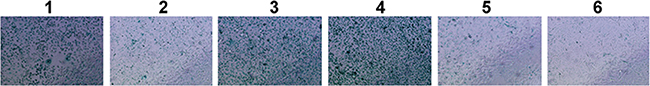 SA-&#x03B2;-gal activity assessment of PFDA treated and transfected AGS cells.