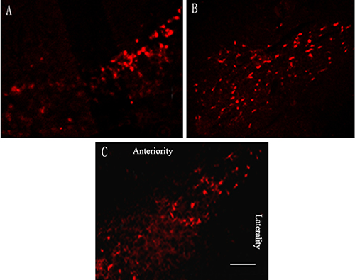 Effects of repetitive transcranial magnetic stimulation (rTMS) treatment on the number of tyrosine hydroxylase (TH)-positive dopaminergic neurons in the substantia nigra of the rats induced by lactacystin (n = 6).