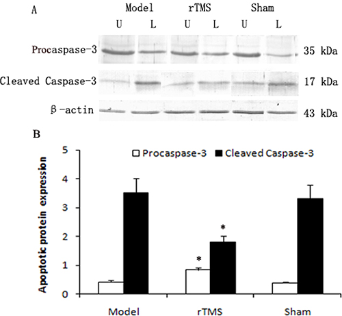 Effects of repetitive transcranial magnetic stimulation (rTMS) treatment on the expression of procaspase-3 and cleaved caspase-3 in the substantia nigra of the rats induced by lactacystin.