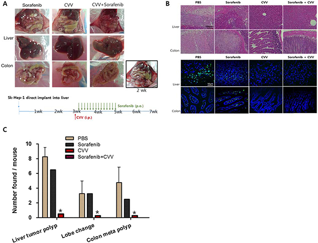 CVV induced complete regression of liver tumorigenicity and metastasis to colon.