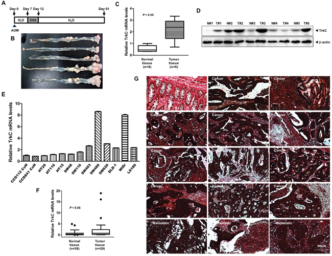 Expression patterns of TrkC in human CRC cells and samples.